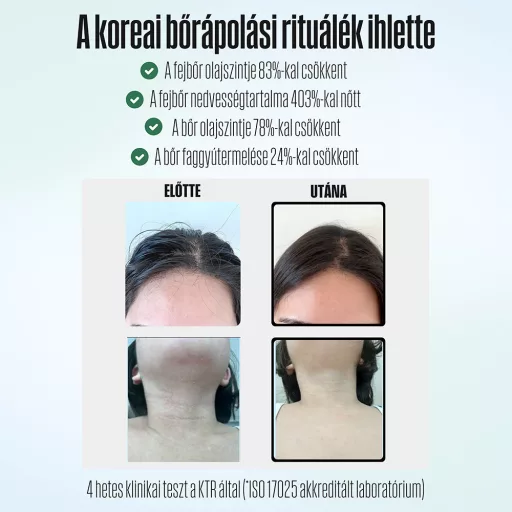 POSEION BT100® Prémium koreai revitalizáló zuhanyfej vízszűrővel, mágneses-ionizáló technológiával, szürke - WaterMarkt.hu